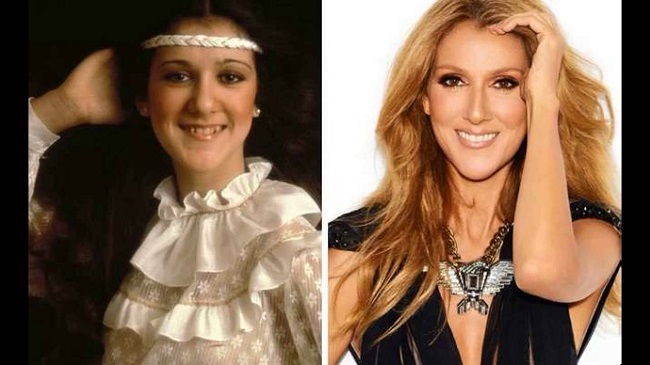 Celine Dion before after