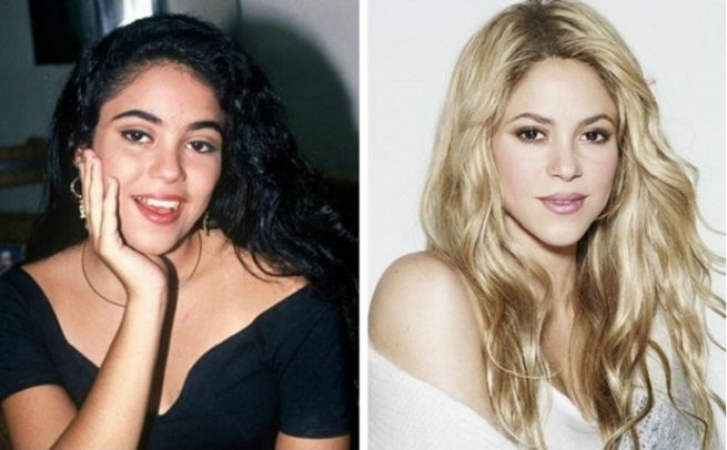 Shakira before and after