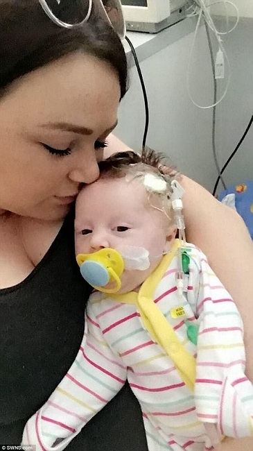 baby born with organ outside body