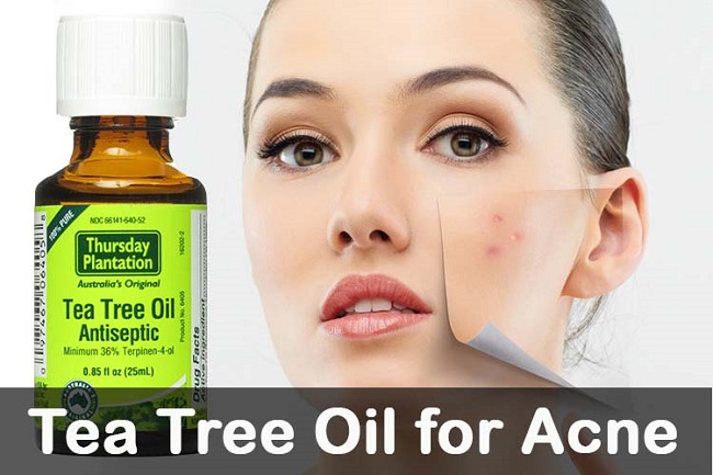 Tea tree oil for acne