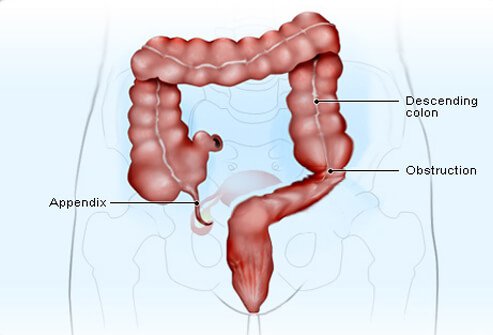 Appendix