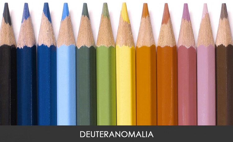 Deuteranomalia