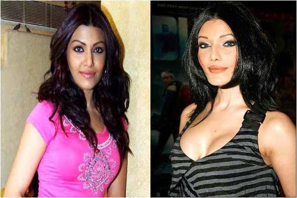 Koena Mitra before and after surgery