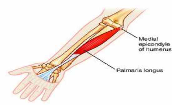 Palmaris muscle