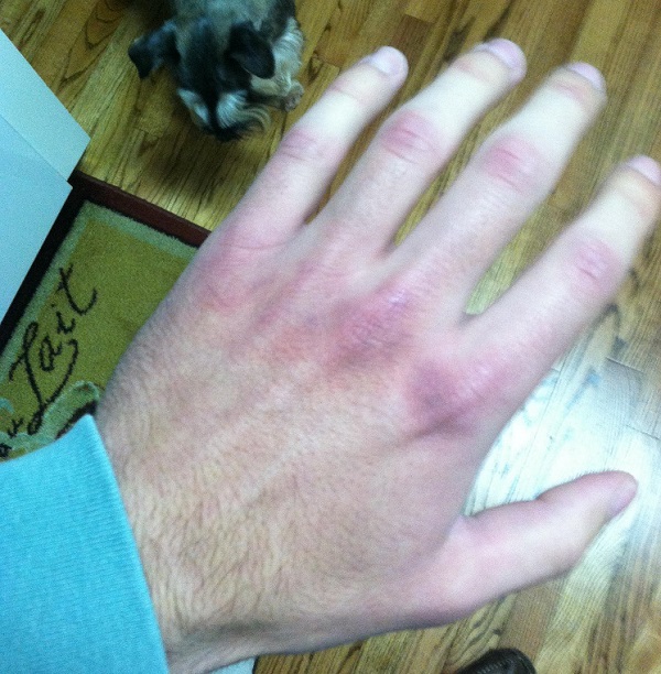 Purple Knuckles