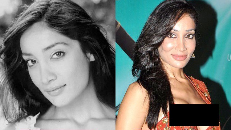 Sofia Hayat before and after surgery