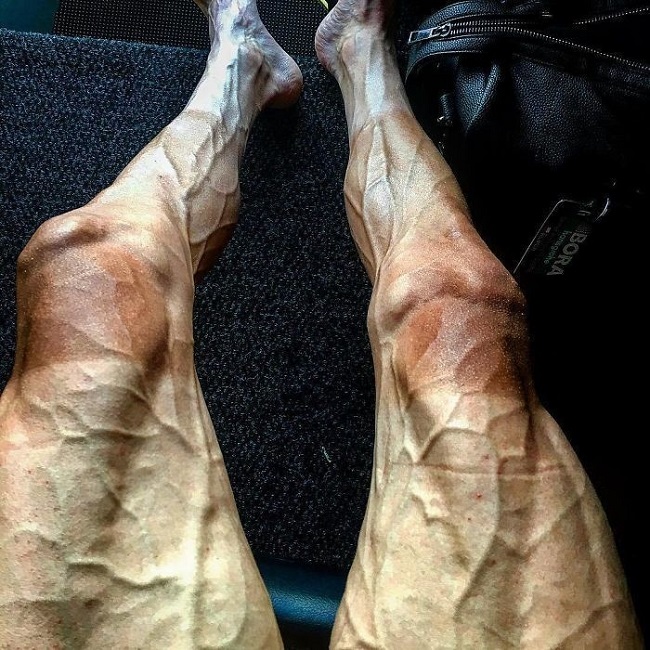 A cyclist legs after the Tour De France