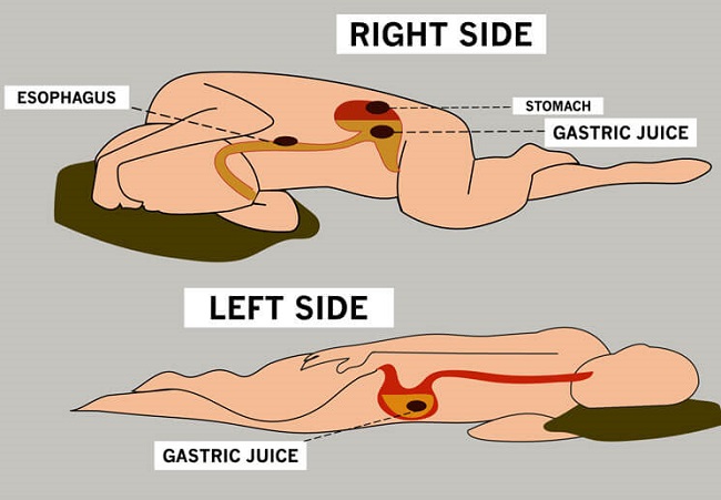 How sleep position affects digestion