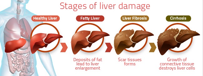 Liver problems