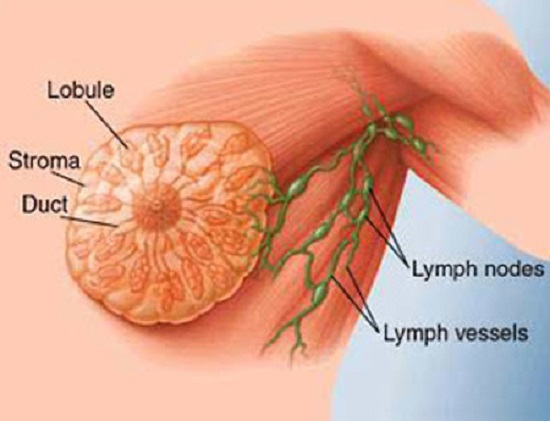 Lymph Node Enlargement