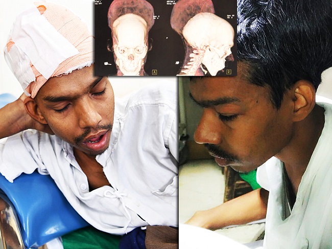 Santlal pal after brain tumor surgery