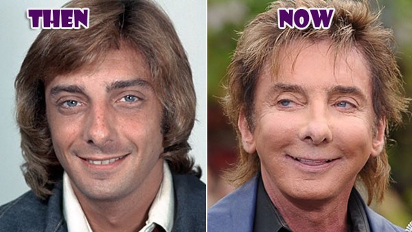 Barry Manilow