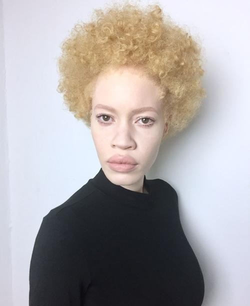 Diandre Forrest first Albino African American model 