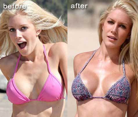 Heidi Montag