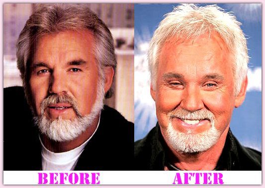 Kenny Rogers