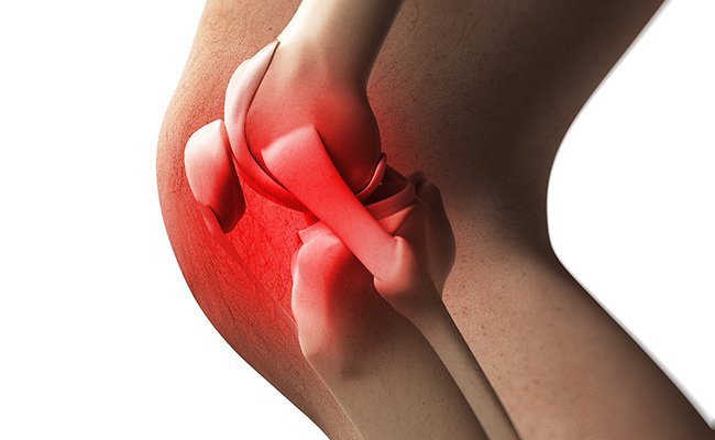 Arthritis can be caused from chronic infection