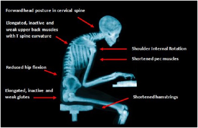 Bad posture for sitting 