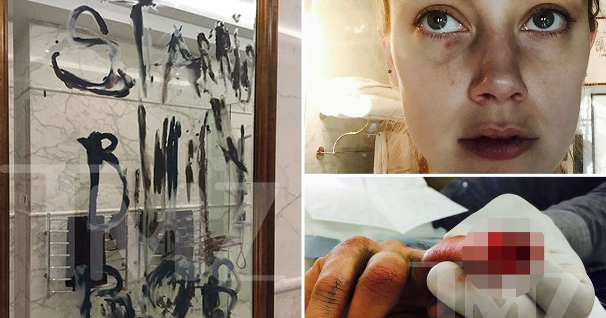 The most bizarre thing in the Johnny-Amber debacle was the pictures The most bizarre thing in the Johnny-Amber debacle was the pictures