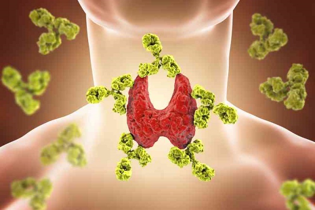 thyroid disorders