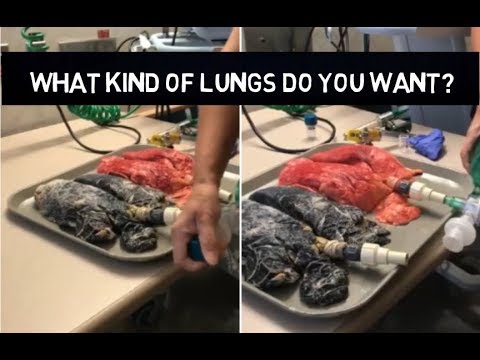 Amanda explains that the healthy lung