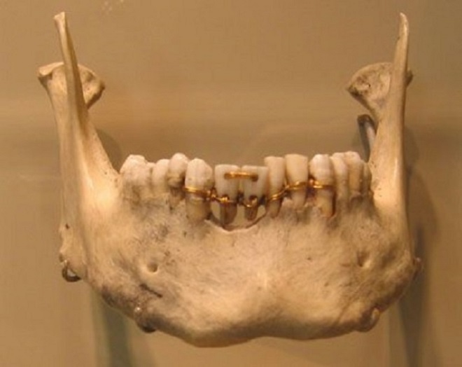 Dentistry in ancient rome