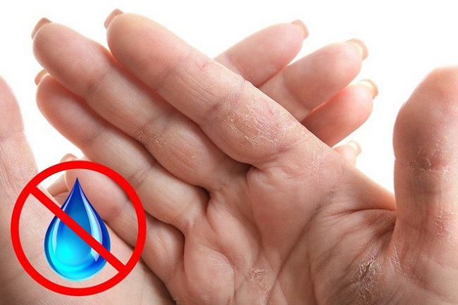 Dry hands