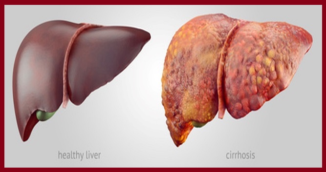 Healthy liver