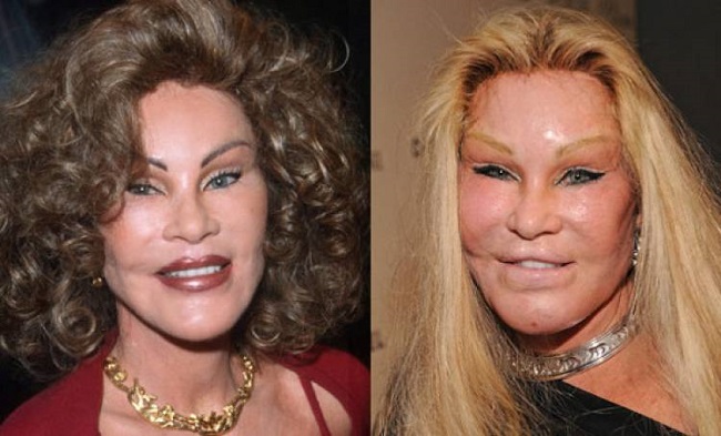 Jocelyn Wildenstein