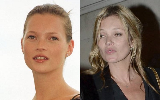 Kate Moss