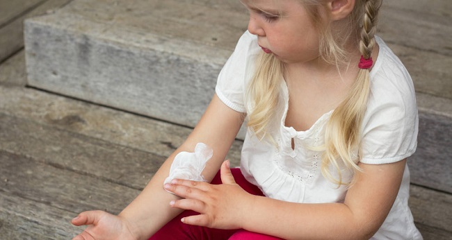 Kids suffering eczema