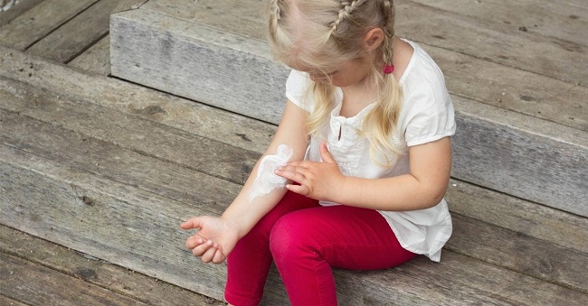 Toothpaste for insect bites