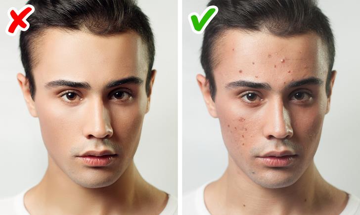 No acne during adolescence