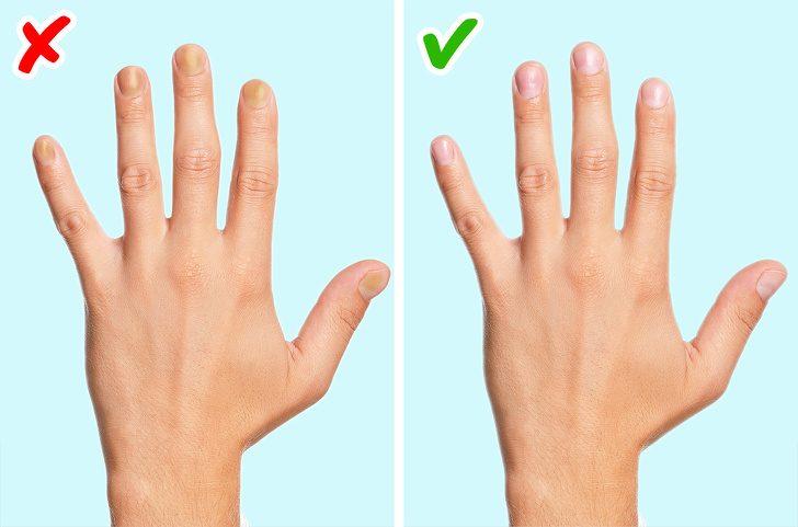 Physical changes in your nails