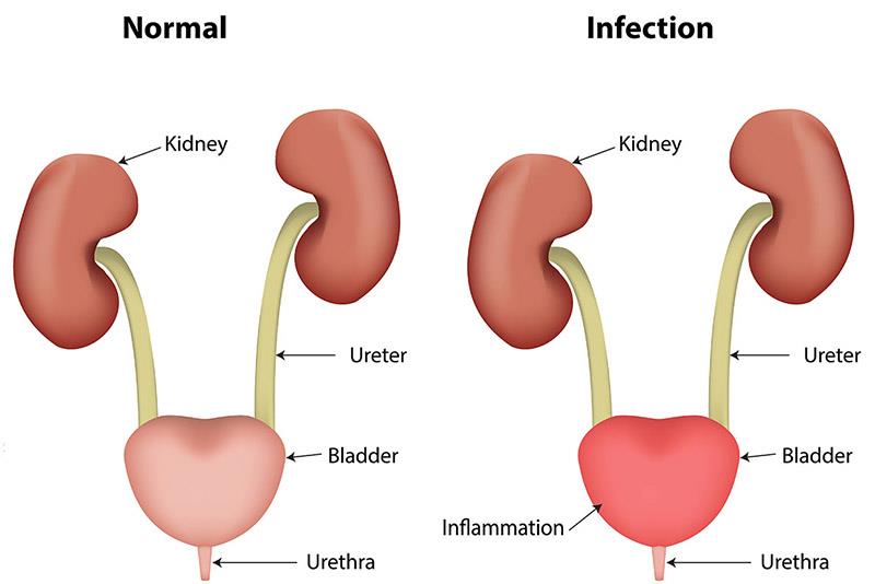 Protects Liver Health