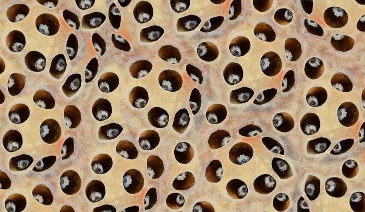 Trypophobia