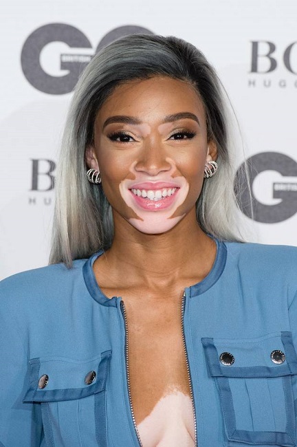 Winnie Harlow