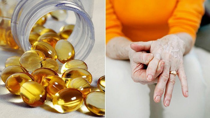 arthritis and vitamin d