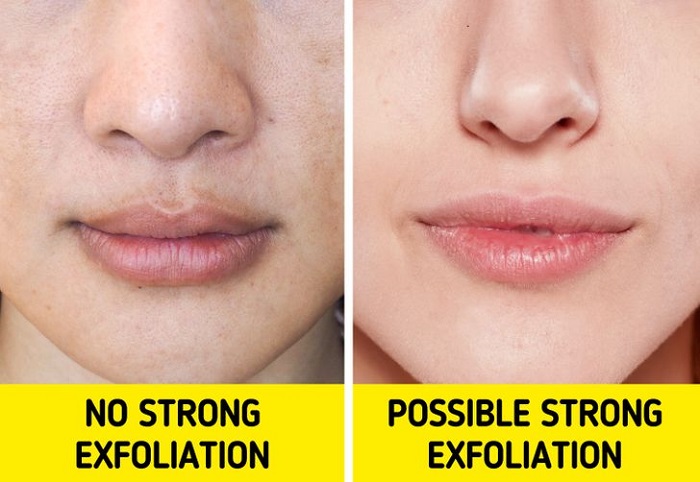 Choose an exfoliation method that suits your skin type Choose an exfoliation method that suits your skin type