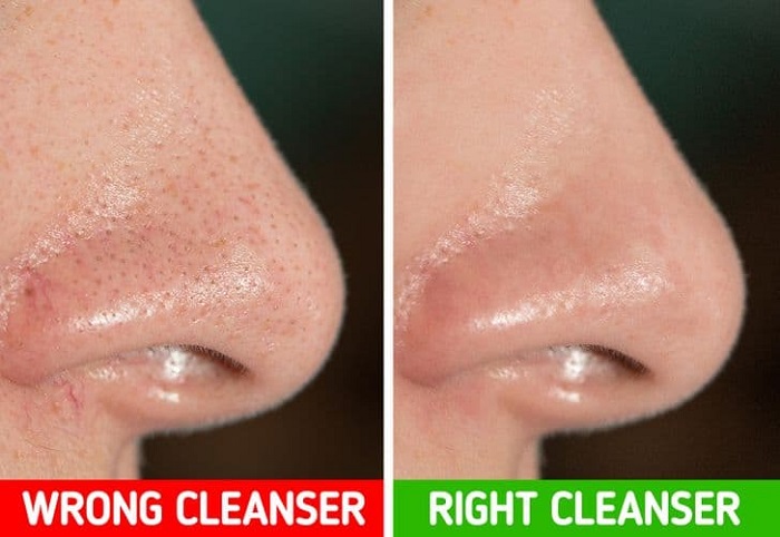 Use only those skin cleansing products that are adjusted to your skin’s natural pH Use only those skin cleansing products that are adjusted to your skin’s natural pH