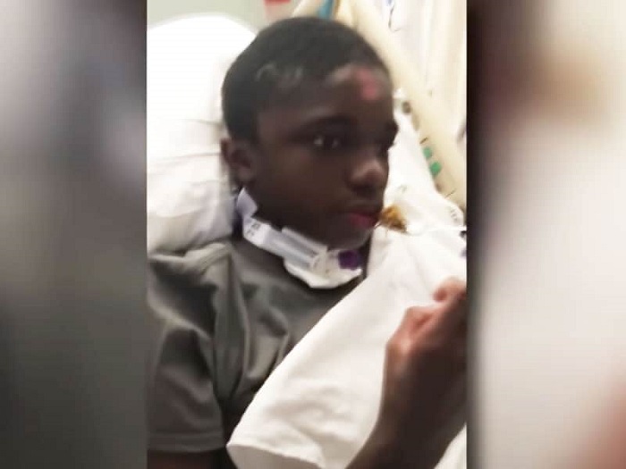 In the end, Brinson survived despite being unconscious for a few months In the end, Brinson survived despite being unconscious for a few months