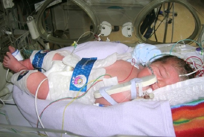 There could be some extra risks for the moms, especially if the labor is unusually challenging There could be some extra risks for the moms, especially if the labor is unusually challenging