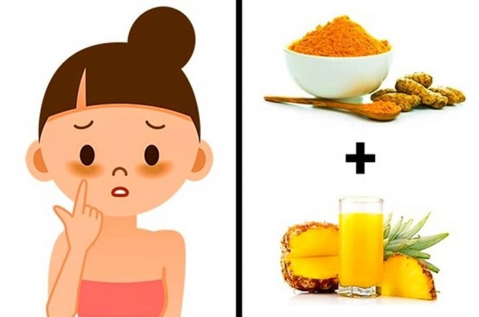 To get rid of dark circles use pineapple juice and turmeric To get rid of dark circles: use pineapple juice and turmeric