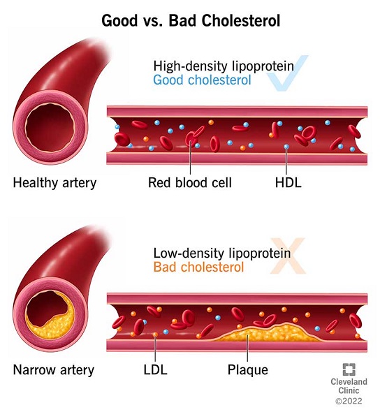 What is cholesterol